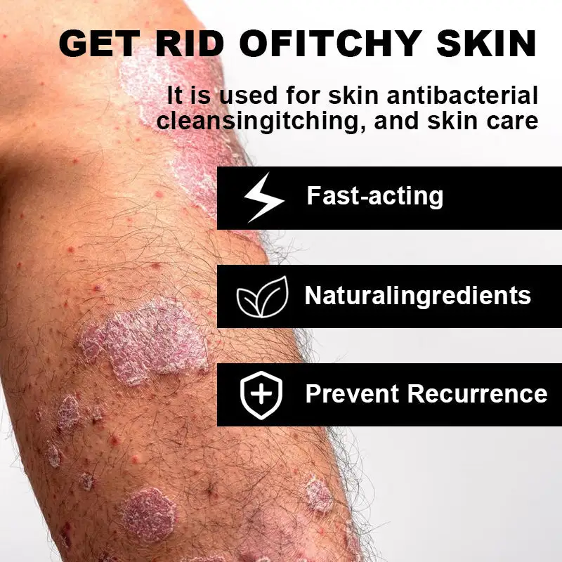 Psoriasis Cure Cream - Image 8