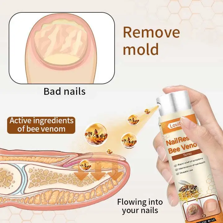 NailRescue Včelí jed ve spreji - Image 3