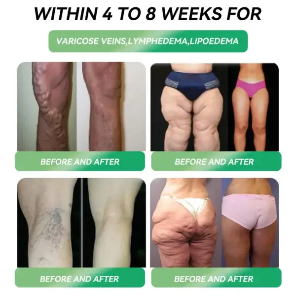 Oral Liquid for Weight Loss - Image 10