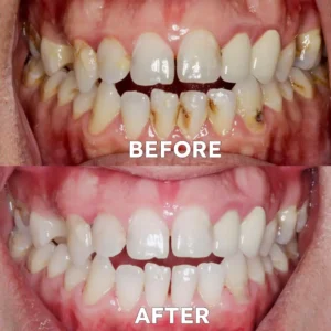 Alternative view of Tooth Health Mineral Powder
