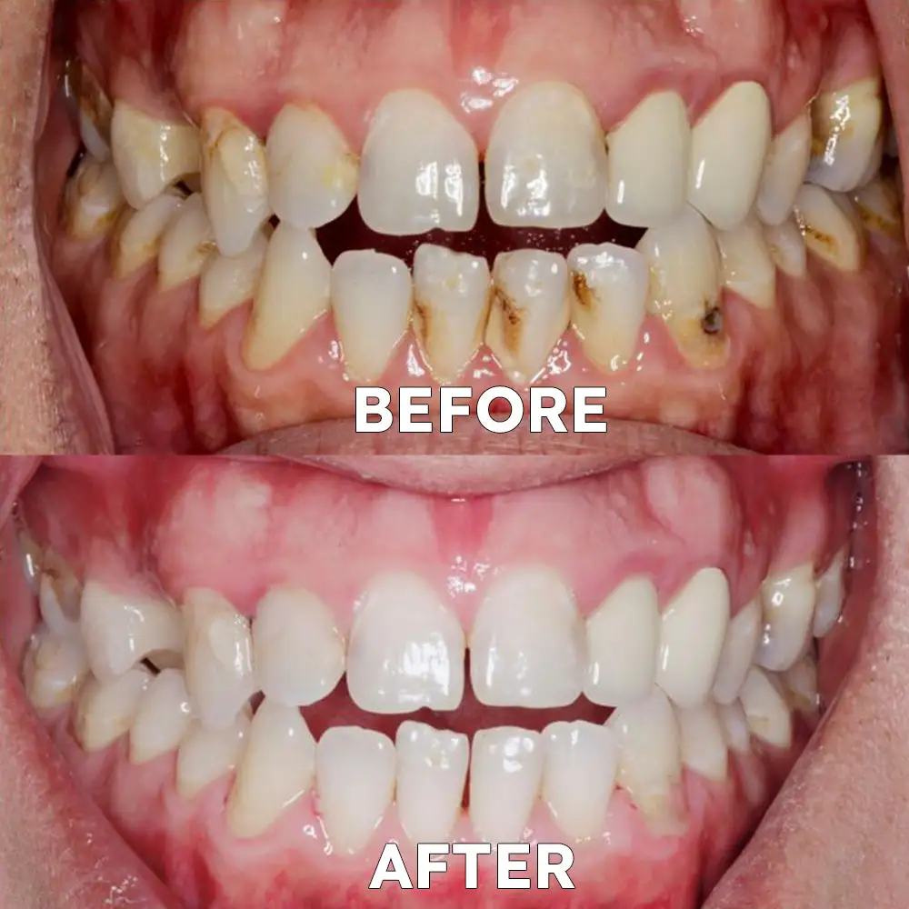 Tooth Health Mineral Powder - Image 2