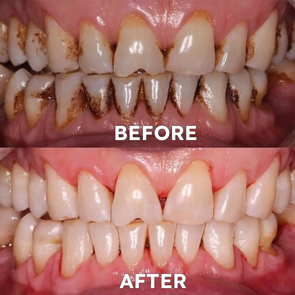 Tooth Health Mineral Powder - Image 4