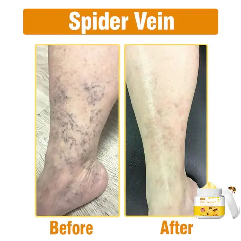 Bee Venom Comprehensive Cream - Image 6