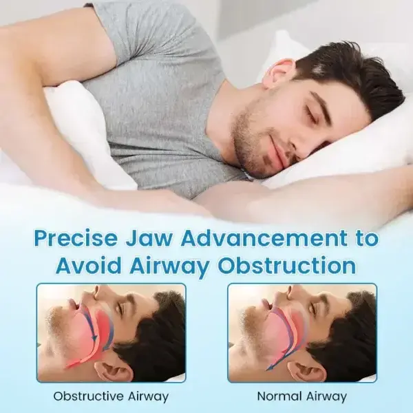 QIAWI ™ Anti-Snoring & Anti-Grinding Teeth Protector - Image 6