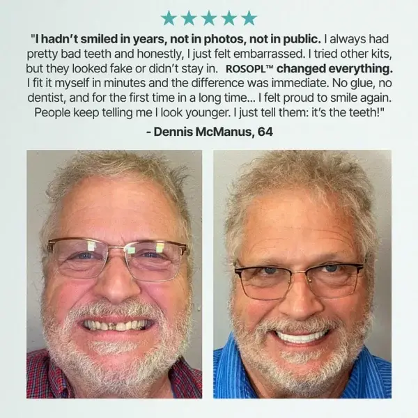 Premium Custom Dentures