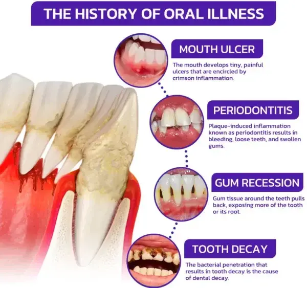 VioGloss Bee Venom Dental Therapy Oral Power - Image 8