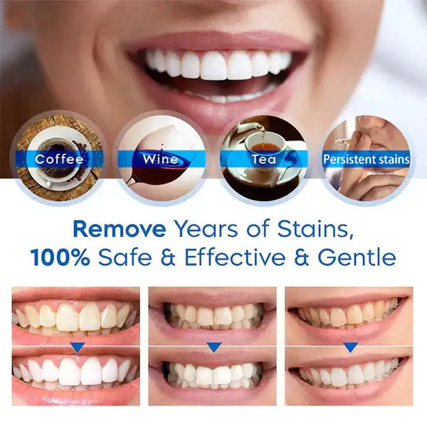 Teeth Whitening Pen - Image 4