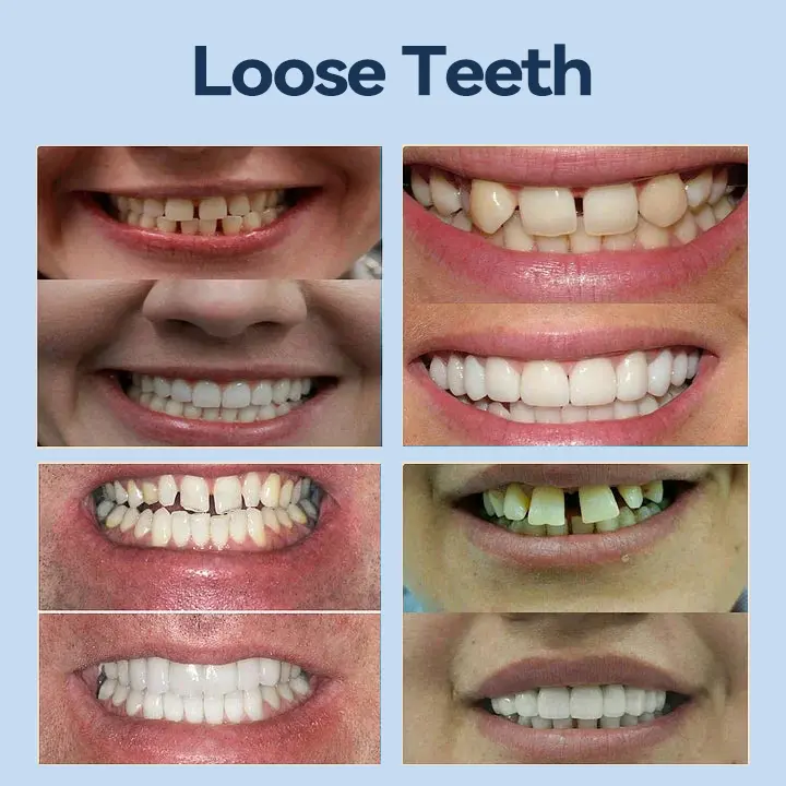 𝐌𝐞𝐝𝐢𝐜𝐚𝐥𝐅𝐢𝐭 𝐀𝐝𝐚𝐩𝐭𝐢𝐯𝐞 𝐃𝐞𝐧𝐭𝐮𝐫𝐞𝐬 - Image 7