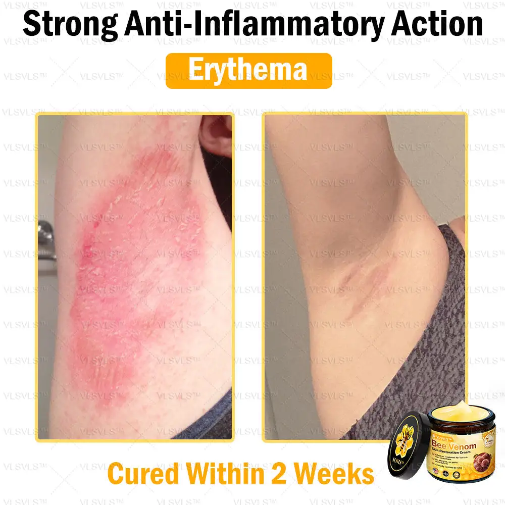 Special Sale Bee Venom Skin Restoration Cream - Image 12