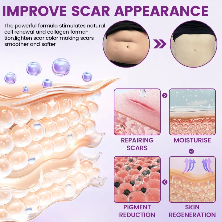 ScarVanisher Scar Gel that Visibly Reduces Scars & Stretch Marks in 2 Weeks - Image 7
