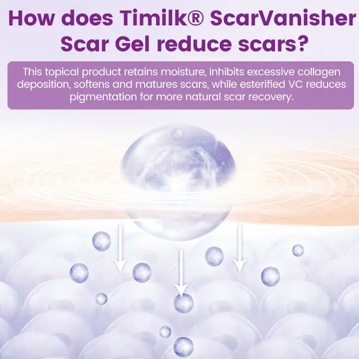 ScarVanisher Scar Gel that Visibly Reduces Scars & Stretch Marks in 2 Weeks - Image 8