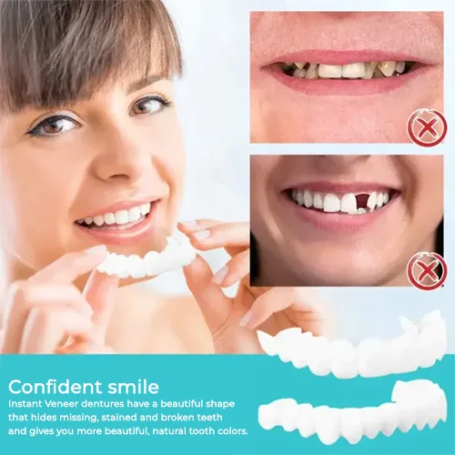 Adjustable Snap-On Dentures - Image 5