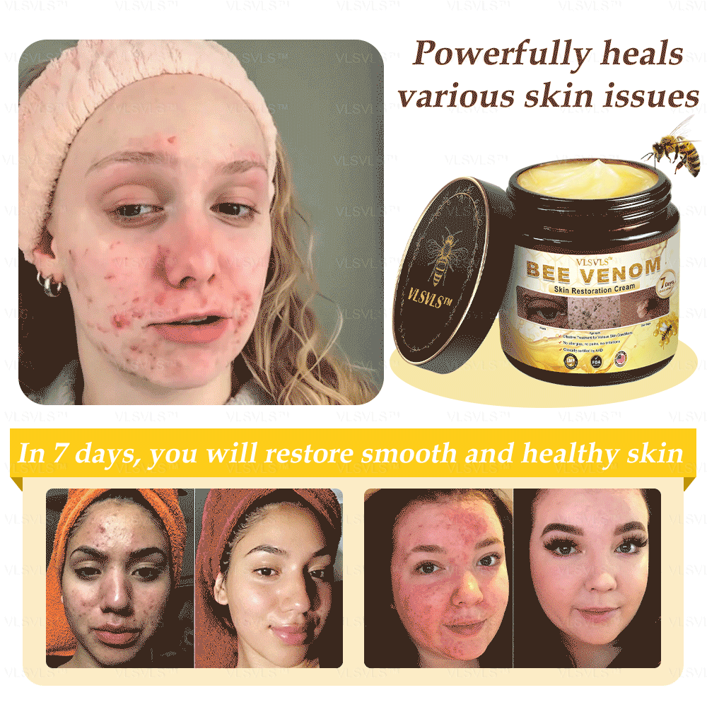 Bee Venom Skin Restoration Cream - Image 2