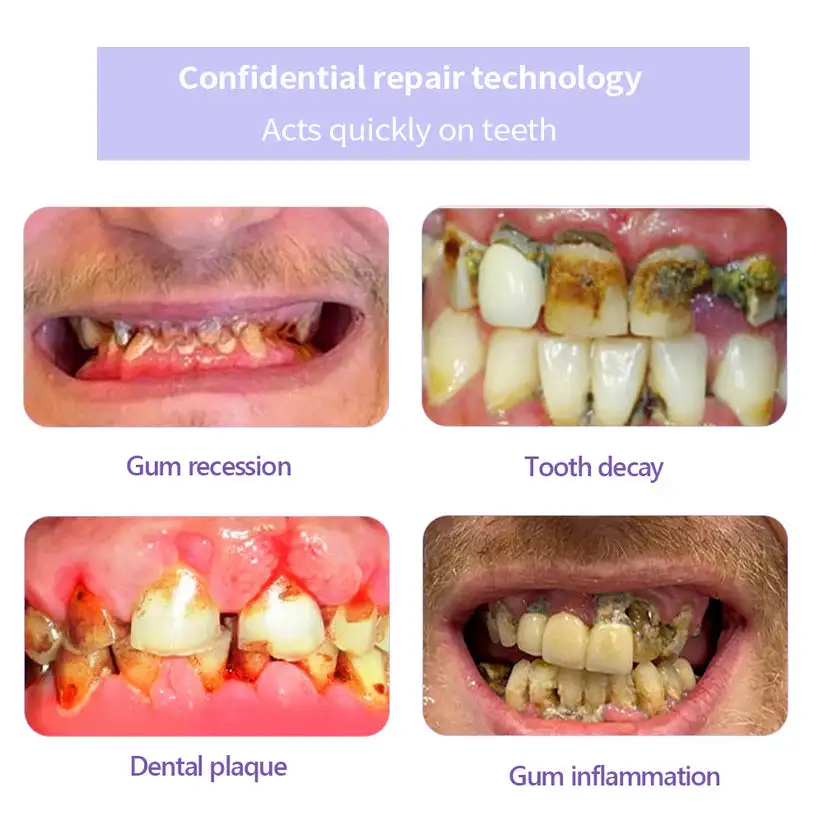 Winter Sale Teeth Restoration Mineral Powder - Image 4