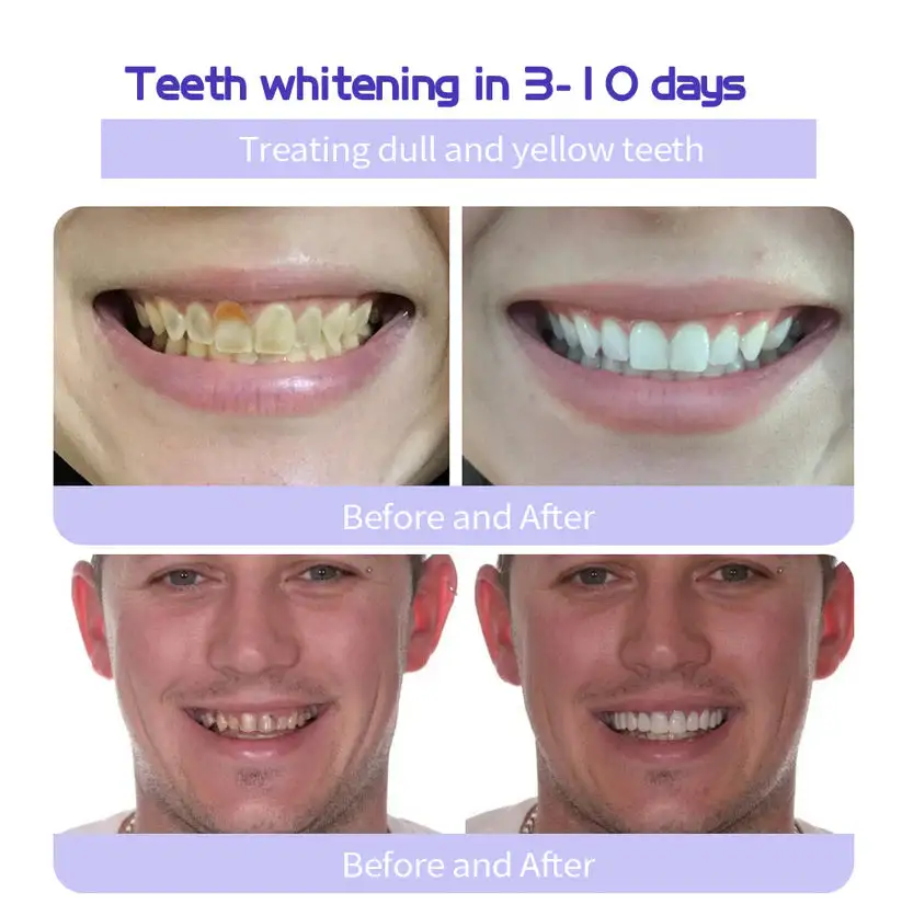 Winter Sale Teeth Restoration Mineral Powder - Image 6