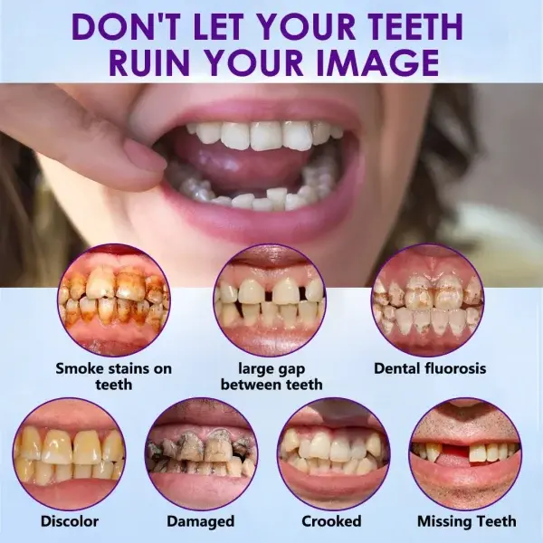 Advanced Customized Full Denture Set - Image 12