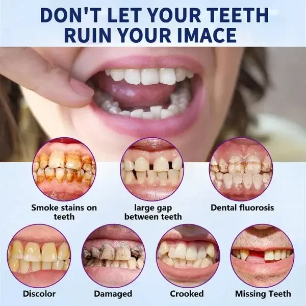 Advanced Customized Full Denture Set - Image 5