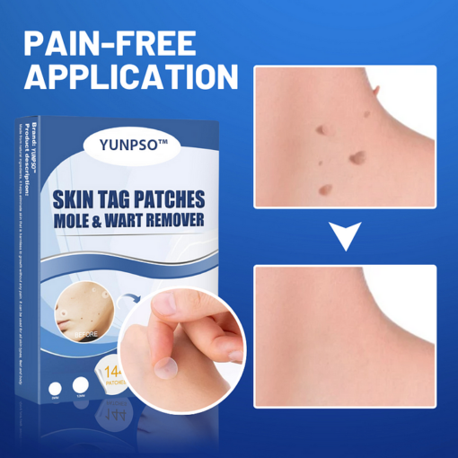 Moles & Warts Removing Skin Tag Patch - Image 4