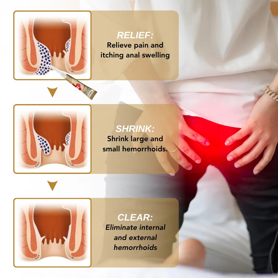 Hemorrhoid Natural Ointment - Image 4