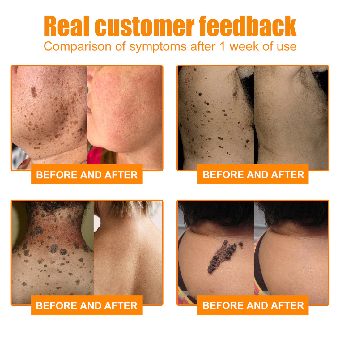 Bee Venom Mole and Wart Treatment Spray - Image 9