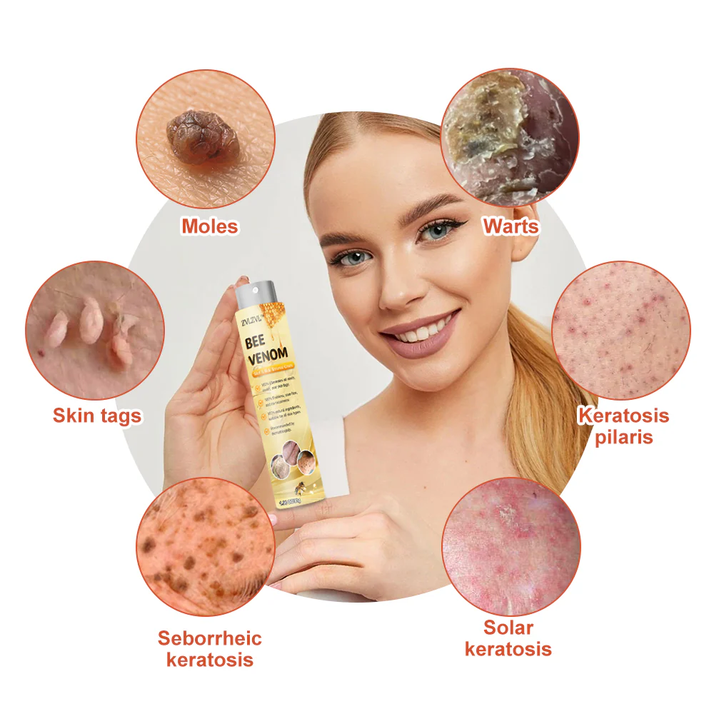 Bee Venom Mole and Wart Treatment Spray - Image 6