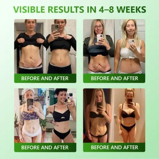 𝐅𝐢𝐫𝐦𝐢𝐧𝐠 & 𝐀𝐧𝐭𝐢-𝐖𝐫𝐢𝐧𝐤𝐥𝐞 𝐒𝐭𝐞𝐦 𝐂𝐞𝐥𝐥 𝐂𝐨𝐥𝐥𝐚𝐠𝐞𝐧 𝐃𝐫𝐨𝐩𝐬 - Image 4