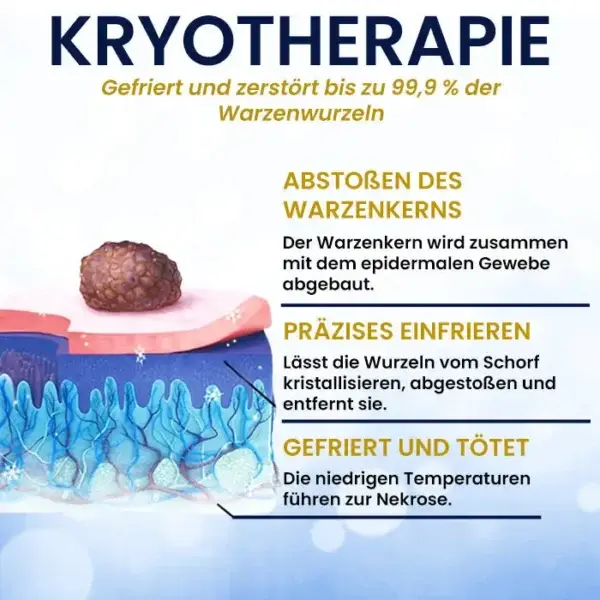 Hautanhängsel-Kryo-Behandlungsspray - Image 6