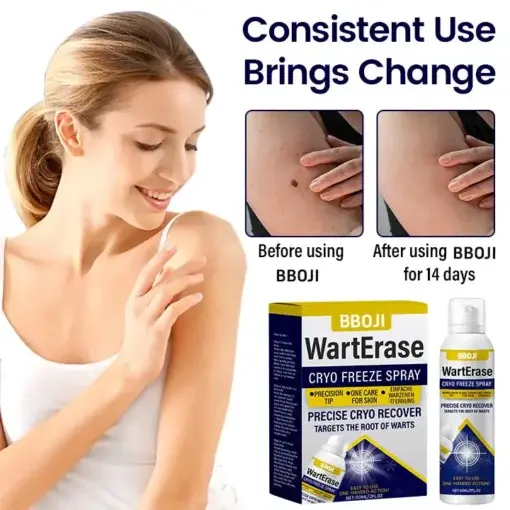 WartErase Cryo Freeze Spray - Image 7