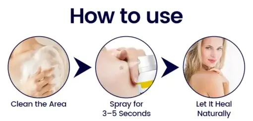 WartErase Cryo Freeze Spray - Image 8