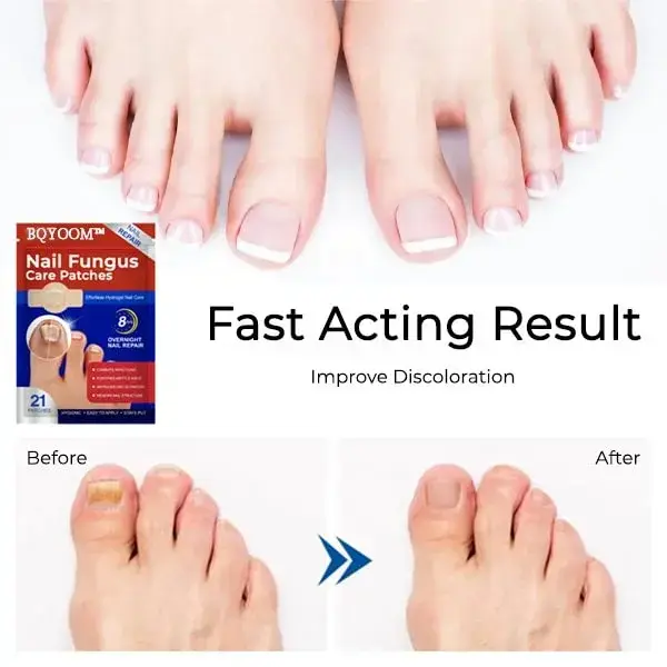 Nail Fungus Care Patches - Image 5