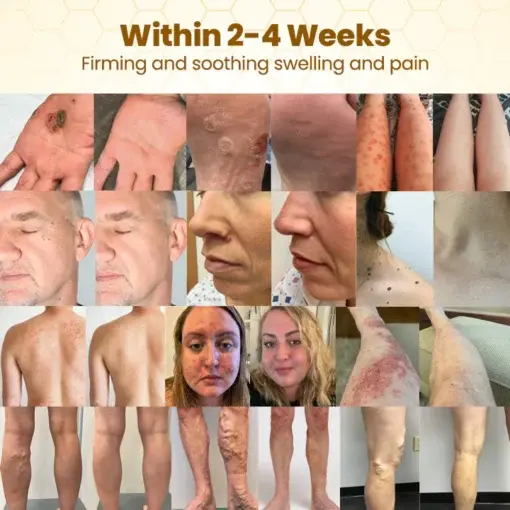 BeeDerma Repair Cream - Image 2