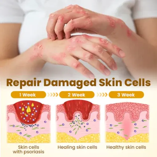BeeDerma Repair Cream - Image 5