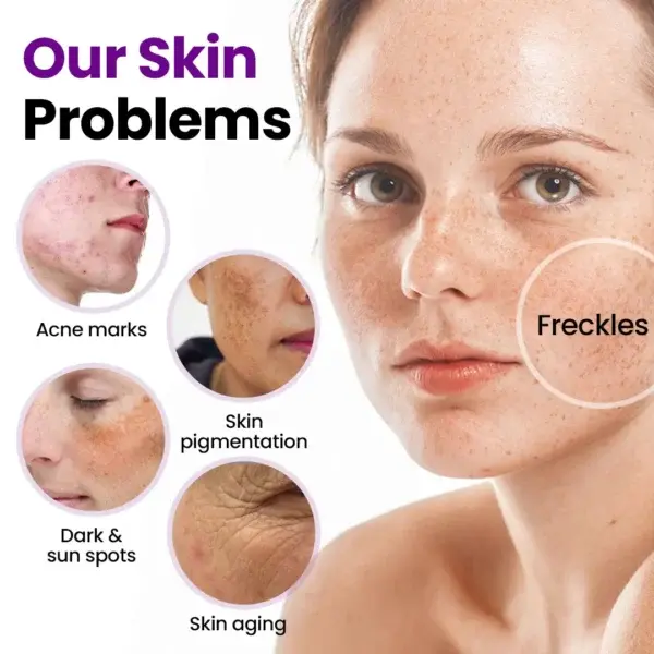 SpotErase Probiotic Shield Serum - Image 5