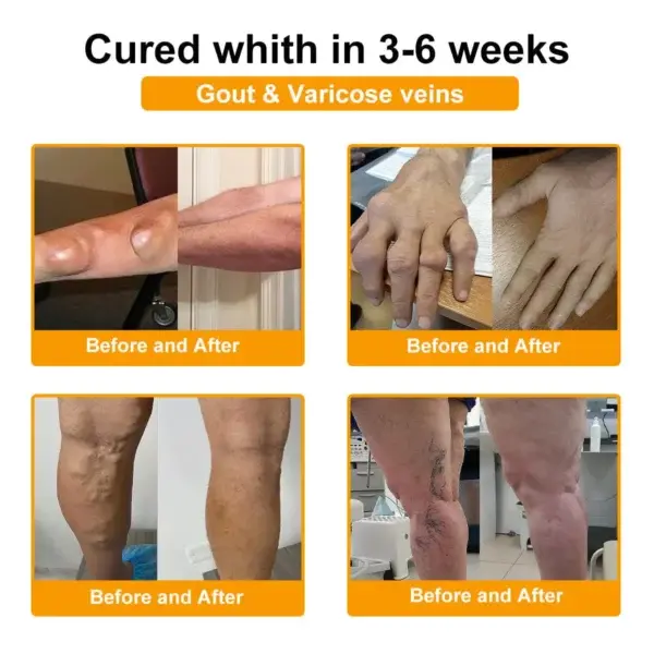 Botulinum Toxin & Bee Venom Orthopedic Relief Cream - Image 15