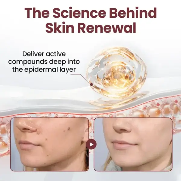 KeraErase Dual-Action Renewal Cream - Image 9