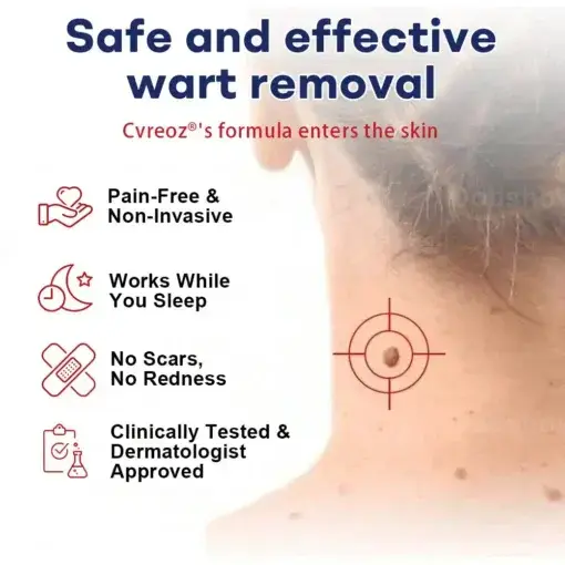 Mole and Wart Removal Cream - Image 4