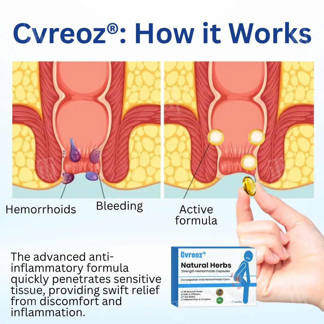 Natural Herbs Strength Hemorrhoids Capsules - Image 6