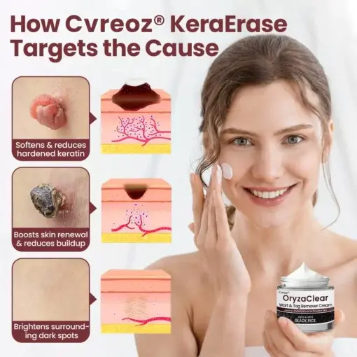 OryzaClear Black Rice Botanical Keratin-Softening Cream - Image 2