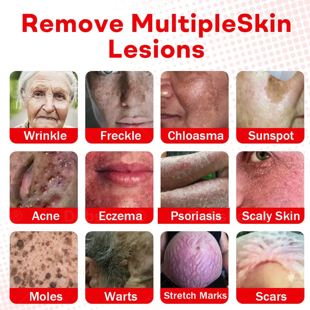 MicroNeedle BotanicSkin Tag Removal Patch - Image 11