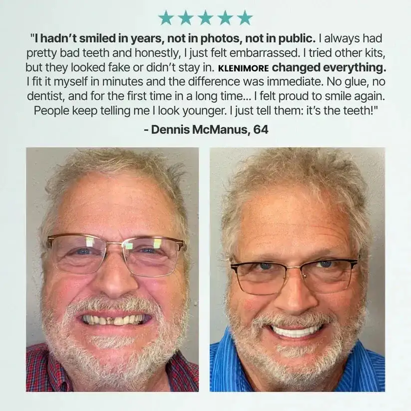 Medical Full Denture with Strong Suctiond - Image 11