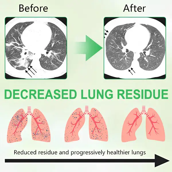 3X Concentrated Mullein Lung Cleanse Spray - Image 4