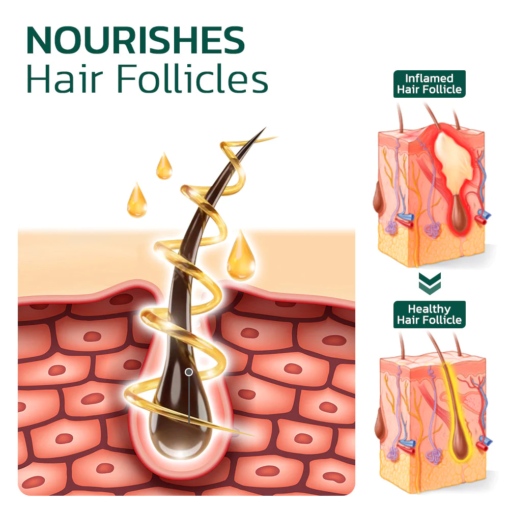 Scalp Folliculitis Therapy Oil - Image 2