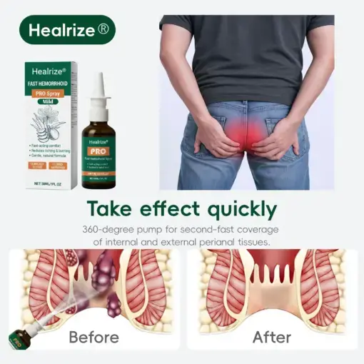 Fast Hemorrhoid PRO Spray - Image 4