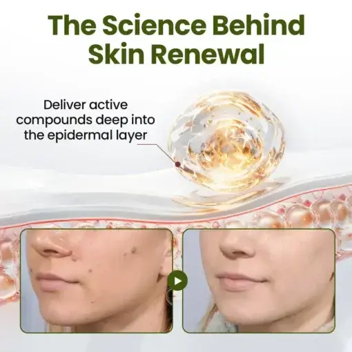 MagneErase Renewal Cream - Image 3