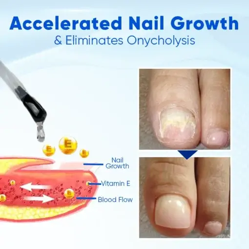 OnyxoGuard Nail Growth and Repair Serum - Image 3