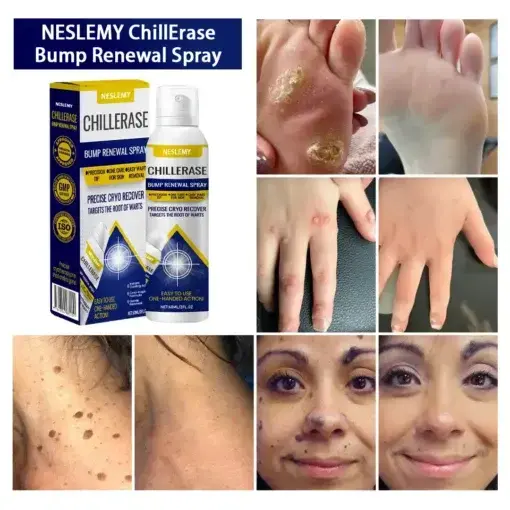ChillErase Bump Renewal Spray - Image 2