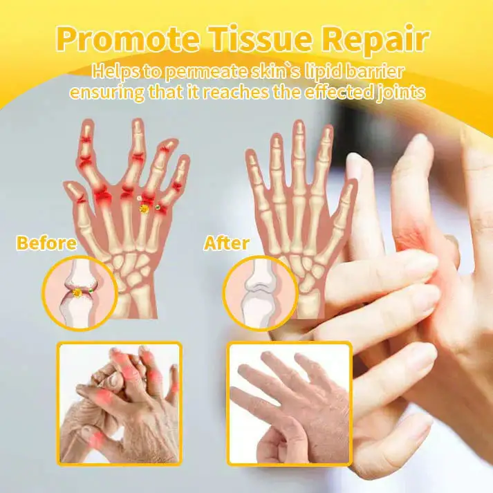 Bee Venom Pain Relief Joint Repair Cream - Image 19