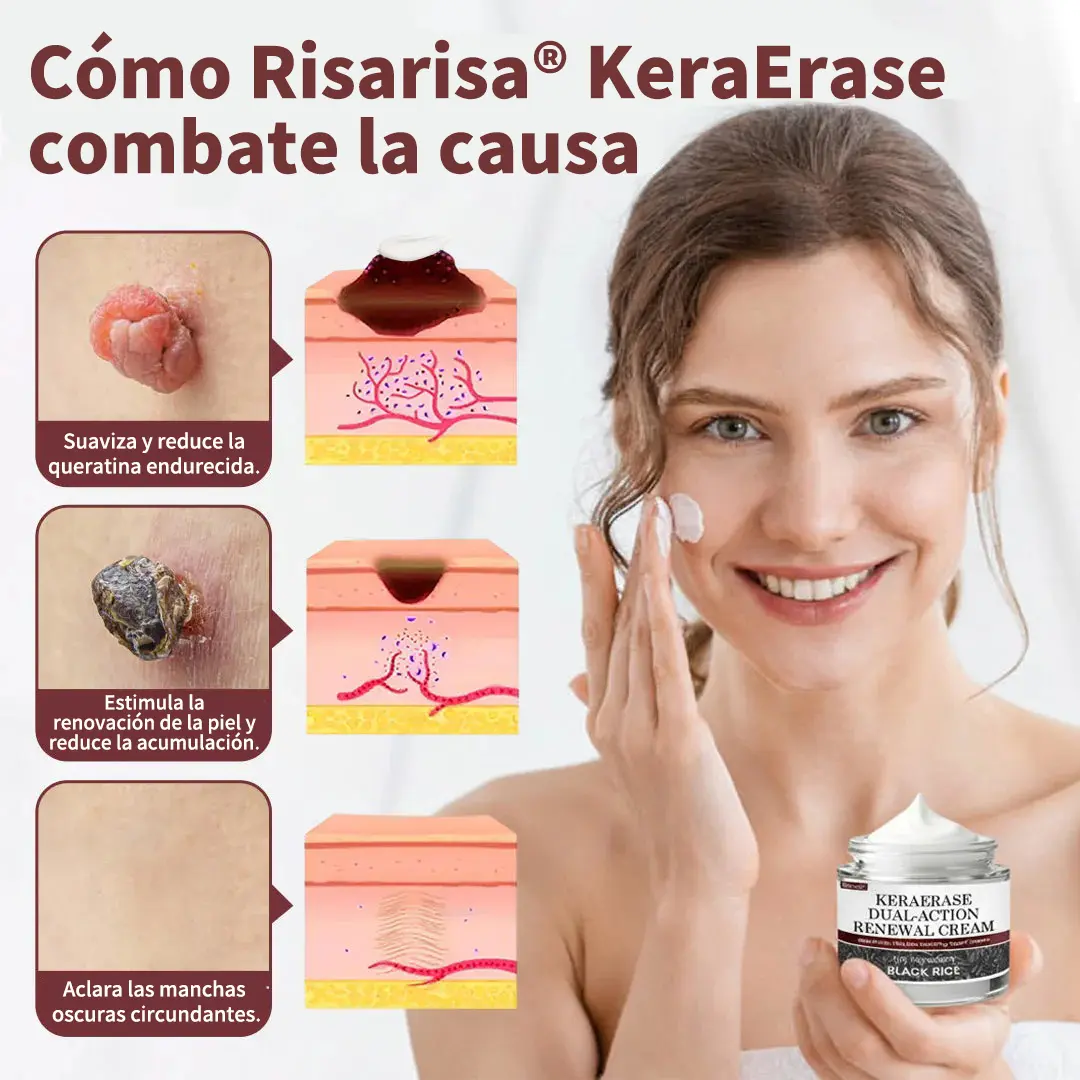 KeraErase Crema Renovadora de Doble Acción - Image 2