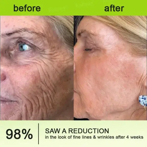 Botox & Vita-A Retinol Shot Wrinkle-Lift Tightening Cream - Image 12