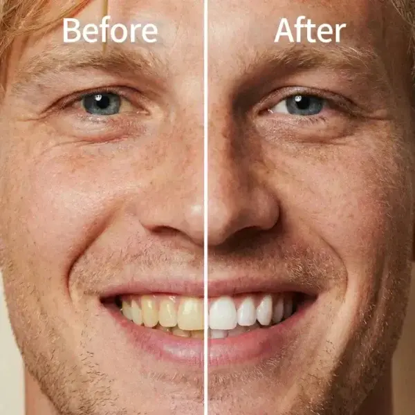 — Instantly Whiter Smile - Image 2